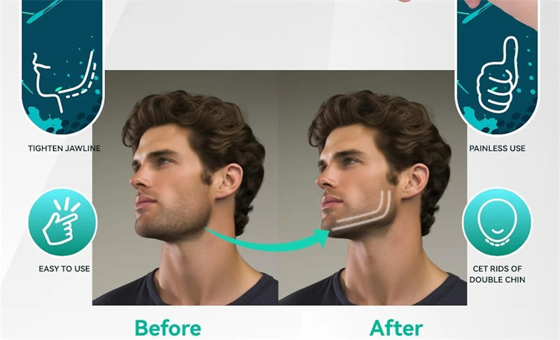 Jaw Trainer